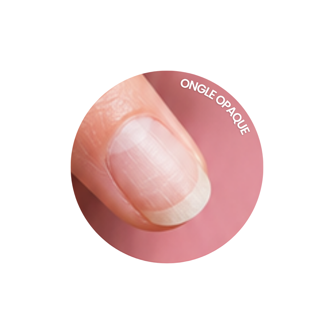 Plaque ongle opaque Zoom sur un ongle opaque, normal