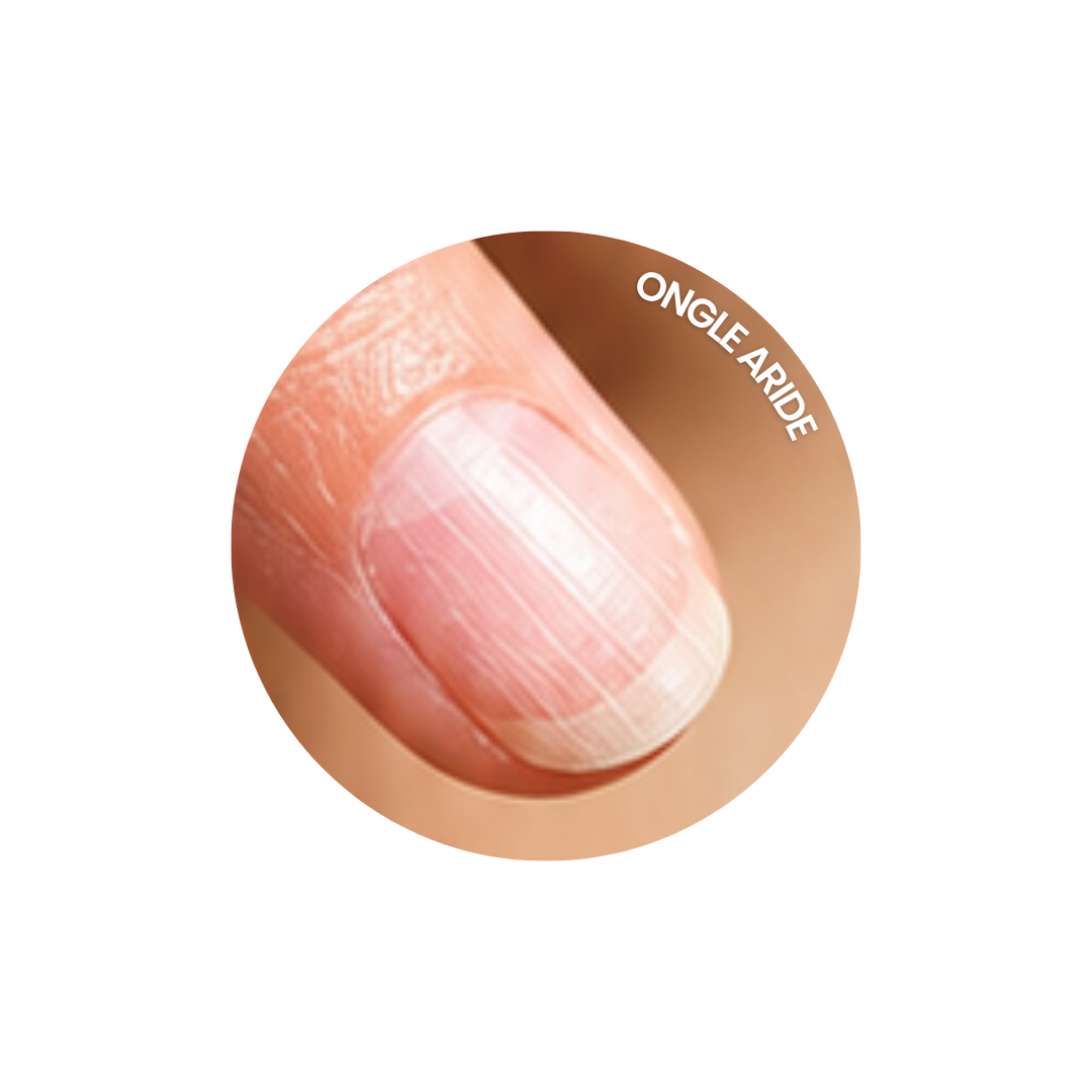 Plaque ongle sec Zoom sur un ongle aride, sec
