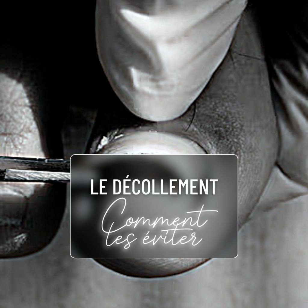 Les dangers du décollement des ongles (onycholyse) et comment l’éviter — free download