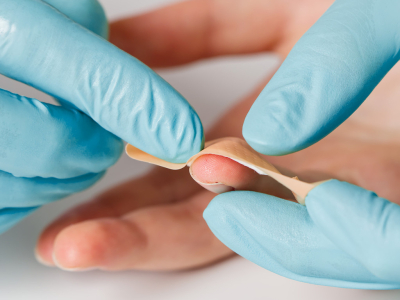Protocole à suivre pour chaque type de maladie des ongles