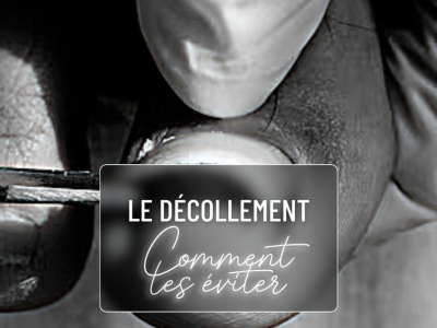 Les dangers du décollement des ongles et comment les éviter