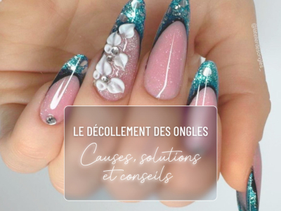Le décollement des ongles : causes, solutions et conseils professionnels