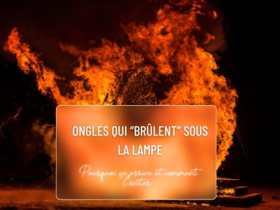 Ongles qui “brûlent” sous la lampe : pourquoi ça arrive et comment l’éviter