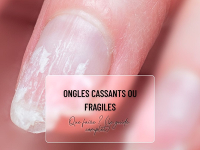 Ongles cassants ou fragiles : que faire ? (le guide complet)